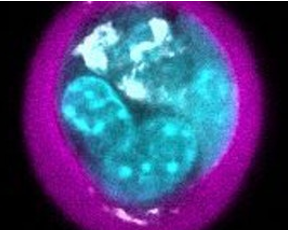 کپسوله‌سازی تک سلولی جهت بهبود سلول درمانی